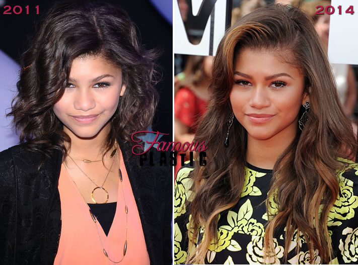 Celebrities... Before and After - Blog